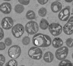 Fundación Reina Sofía